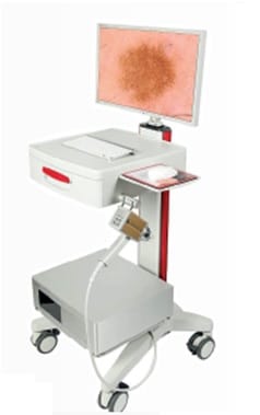 videodermatoscopio digitale