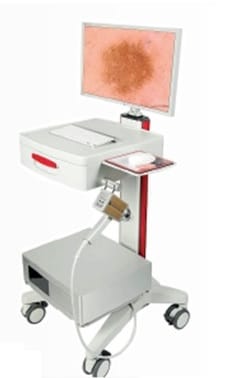 videodermatoscopio